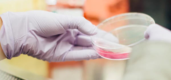 Unsplash- Hand Holding Lab dish