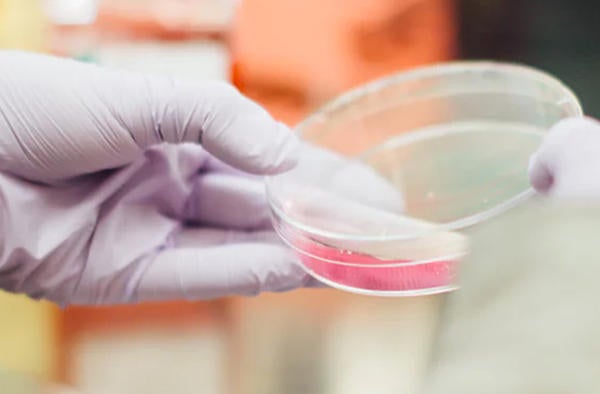 Unsplash- Hand Holding Lab Dish